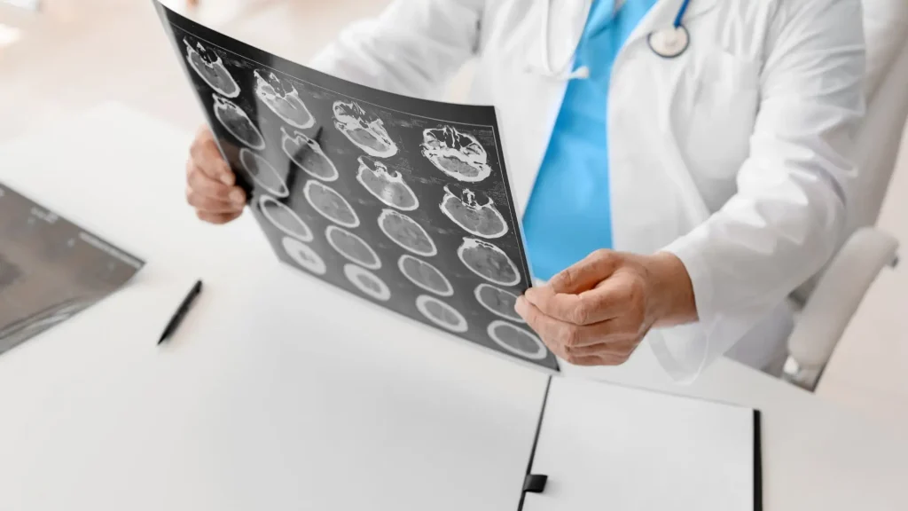 What Is Traumatic Brain Injury Dementia_ Image raw